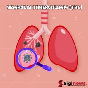 Pembelian TCM untuk TBC Oleh Kemenkes Diduga Dobel Anggaran ?